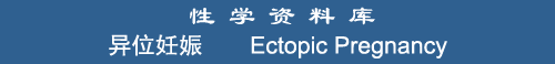 Ectopic Pregnancy